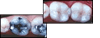 before and after